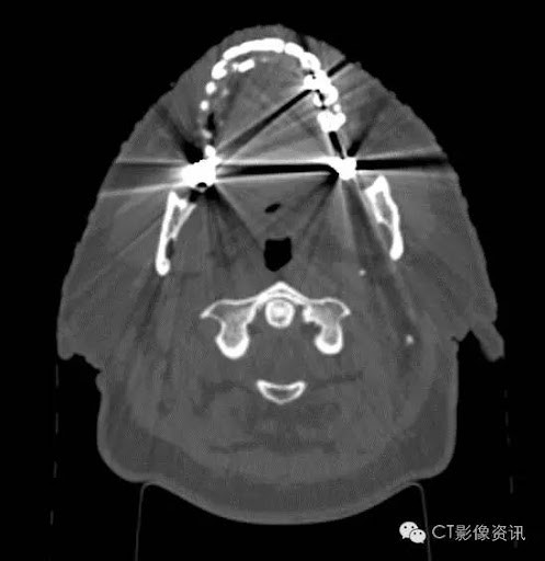 医疗CT拍摄