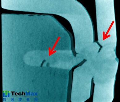 微焦点CT断层切面图像