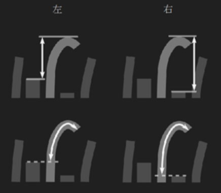 阳极超出分析示意图，显示投影距离与轮廓距离的量测